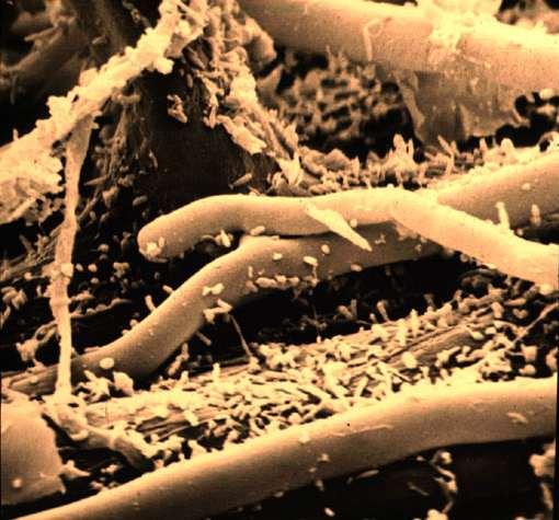 Healthy Soil is Full of Life Fungal hyphae Soil Bacteria Image