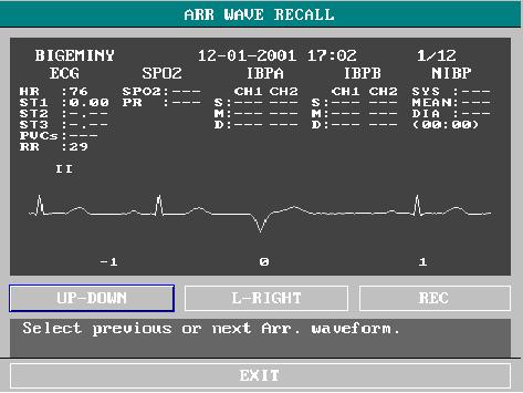 ECG/RESP Monitoring Figure 12-14 ARR WAVE RECALL Menu If there are more than 60 Arrhythmia events, the latest will be retained. ARR ALARM The alarm is triggered when an Arrhythmia occurs.