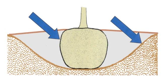 Changes in soil texture (actually soil pore space) create a texture interface that impedes water and air movement. Figure 25.