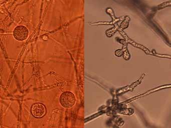 Pythium Diseases Cause: Pythium spp. Pythium spp. may cause preemergent seed rot and damping-off, postemergent damping-off, stem and root rot, blight, or pod rot.