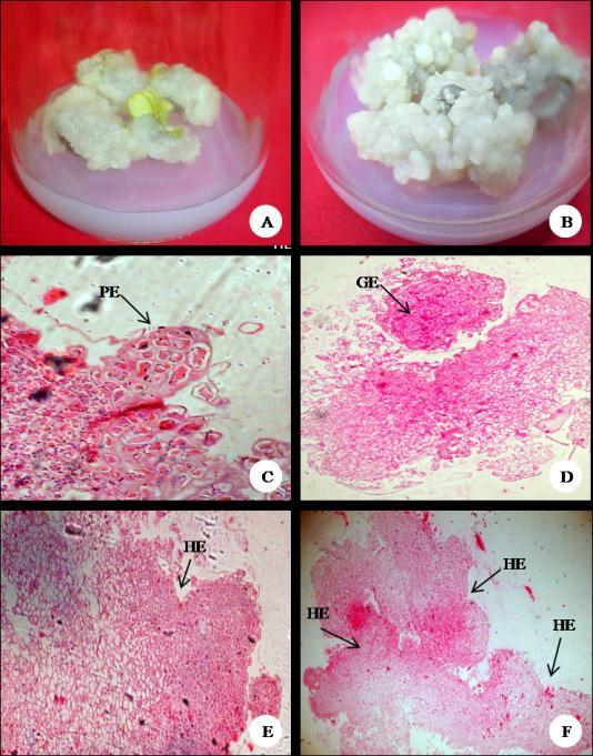Fig. 2. Proliferation and histological sections of embryogenic leaf callus of G.latifolia meristematic cells. These small, thin walled cells had nuclei and were grouped in cell masses.