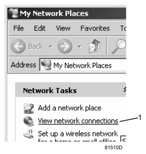 Select the Local Area connection