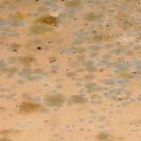 Indoor Mold and Health A Fungus among Us This article addresses some of the most common questions and concerns about indoor mold, how it affects human health and ways in which you can prevent or