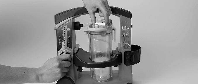 The Serres Suction Bag system contains a hydrophilic filter that shuts off the vacuum if the canister is full or the LSU tips over. To restore the vacuum, replace the Suction bag.