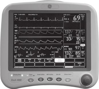 SPO 2 Both SPO 2 technologies include the following menu options: Size adjusts the size of the displayed SPO 2 waveform. The default size is 1x. Rate turns the displayed rate value on and off.