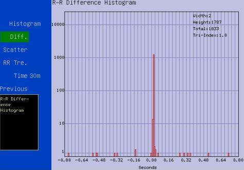 (2) R-R interphase difference histogram: It reflects the difference of R-R interphase, namely, the extent of sinus arrhythmia.