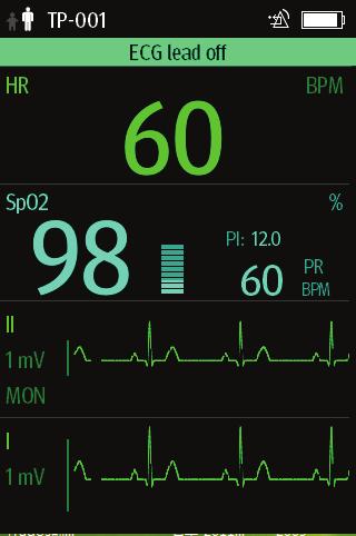 Touch Screen Display General Product Description 2.8.1 Display Screen The main screen displays patient parameters and waveforms. A typical display screen is shown below. 1 2 3 4 5 1.