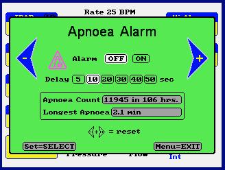An apnoea is defined as a cessation of spontaneous breathing for the set time delay. Ventilation will continue at the backup rate during apnoea events.