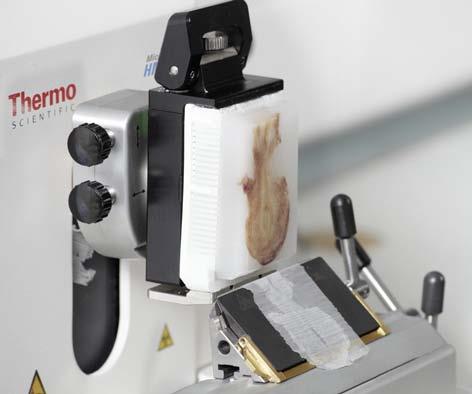 Thermo Scientific Microm HM355S rotary microtome Leading in terms of safety, ergonomics and efficiency Save time and material and reduce stress. Make life easy for yourself.