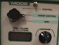Modes Control Assist/Control SIMV - machine "looks" for a patient inspiratory effort 6 seconds