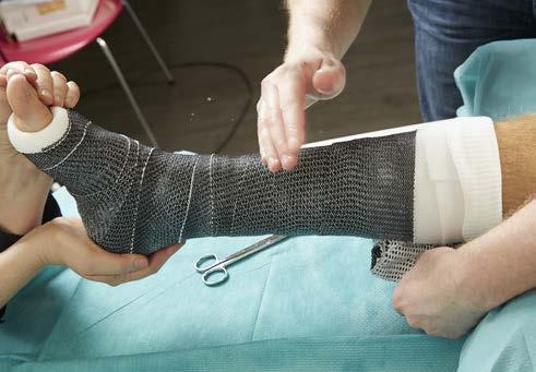 To remove the cast or splint C-LITE can be removed with ordinary casts instruments such as