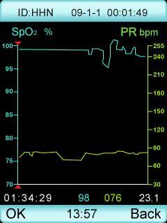 Under trend review mode as figure 15,the white number on the left bottom is current recording time point,the middle blue number is SpO2 value,green number is pulse rate value,the white number on the