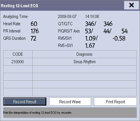8.9.2 Interpretation of resting 12-lead ECG WARNING Interpretation of resting 12-lead ECG is restricted to adult patients only.