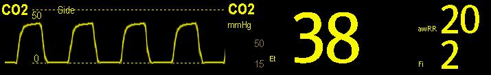 19 Monitoring Carbon Dioxide 19.