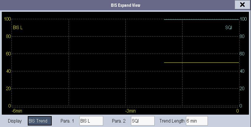 23.3.3.2 Displaying BIS Trend You can the desired trend lines to be displayed and set the time scale. The artifact mark is displayed at the bottom to indicate SQI value.