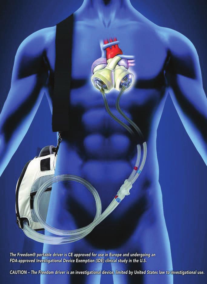 Questions and Answers for Total Artificial Heart What Is A Total Artificial Heart? A total artificial heart (TAH) is a device that replaces the two lower chambers (ventricles) of the heart.
