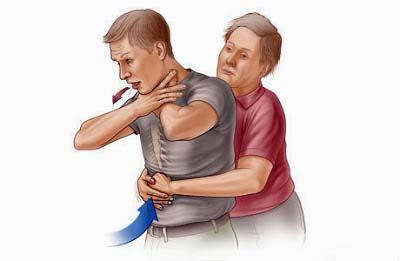 First Aid for Choking Conscious adults 1. If someone cannot breathe, cough or speak 2. Ask, Are you Choking and ask the victim if you can help them.