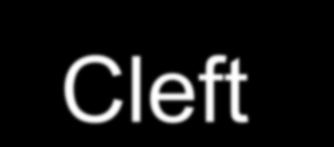 Cleft