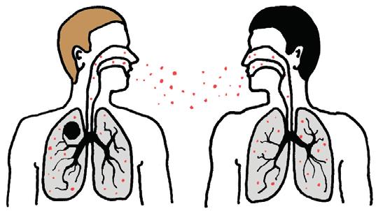I Pagrindai Tuberkuliozė TB yra oro-lašeliniu būdu perduodama infekcinė liga, sukeliama bakterijos Mycobacterium tuberculosis.