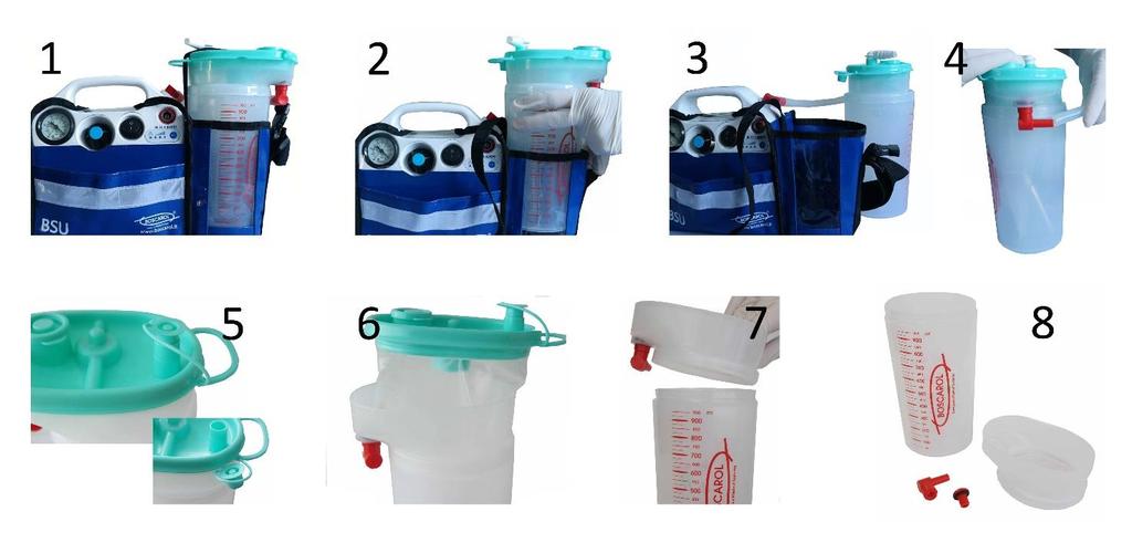 2. Pull the jar vertically out of the unit. 3. Disconnect the patient tubing together with the white angular connector for the disposable liner and discard it. 4.