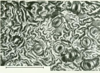 Figure 12.5 Apple leaf surfaces observed under the microscope, showing open (A) and closed (B) stomatal pores. The bar on both micrographs equals 100 µm.