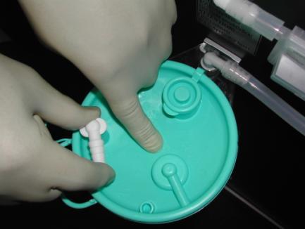 center point of the suction bag s lid (see Fig. 34).