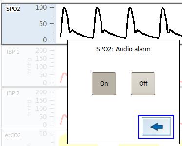 5.5.5. Activate and deactivate the alarm function It is possible to completely deactivate the alarm function for audible alarms. MIPM strongly recommends to leave the alarm function enabled!