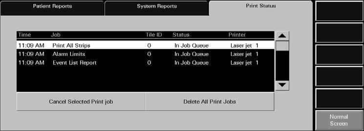 Report Functions Print Status Tab 8.3 Print Status Tab The Print Status tab (shown in FIGURE 8-24) contains a list of current print requests.
