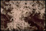 bacteria Looks and acts like a fungus Streptomycetes spp.