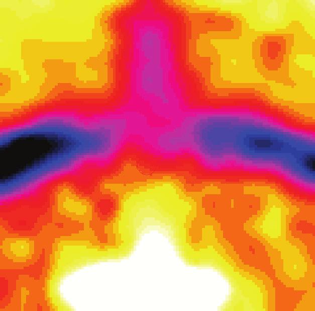 infrared thermal photography integrated with isothermal cooling water.