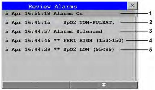 5 Reviewing Alarms To review the currently active alarms and INOPs, select any of the alarm status areas on the fetal monitor screen. The Alarm Messages window pops up.