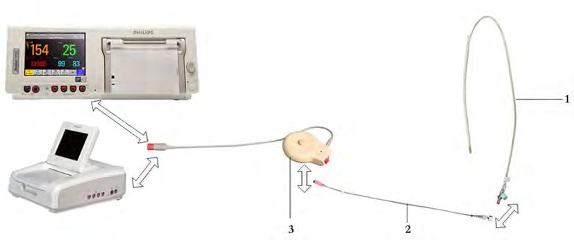16 Monitoring Uterine Activity Internally Illustration 2 shows the complete connection chain from the IUP catheter to the fetal monitor using