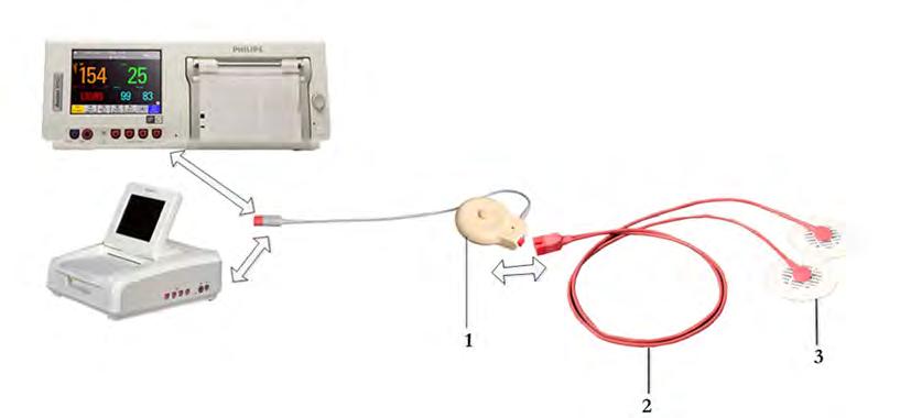 Illustration 1 shows the complete connection chain from the foam electrodes applied to the patient to the fetal monitor using the patient module.