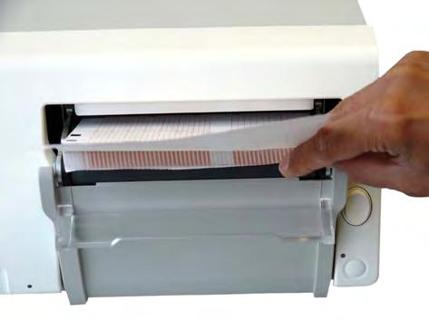 3 Basic Operation 6 A - Protrusion holds paper guide in closed position. 7 Prepare to place the new pack of paper in the tray with the bottom side down.
