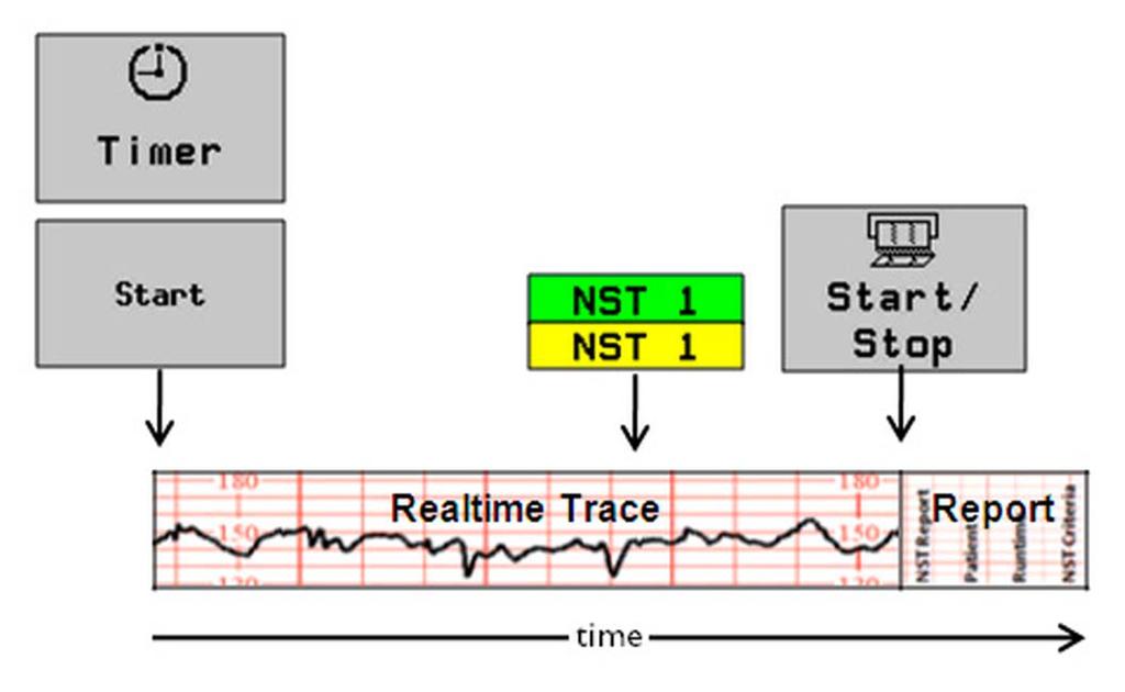 6 Monitor Settings Recording Trace Automatically and NST Report Manually After Recorder Stop To configure this use model, configure the following settings: Setting Item Main Setup > NST Report >