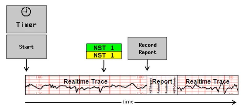 6 Monitor Settings Recording Trace Continuously and NST Report Manually To configure this use model, configure the following settings: Setting Item Main Setup > NST Report > Setup > Setup NST Report