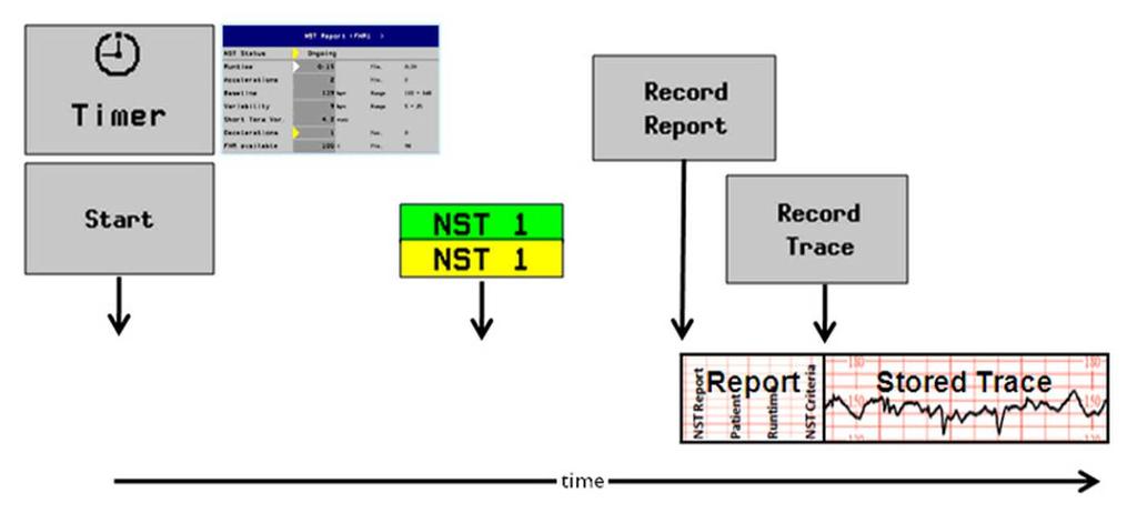 6 Monitor Settings Recording NST Report and Stored Trace On Demand To configure this use model, configure the following settings: Setting Item Main Setup > NST Report > Setup > Setup NST Report >
