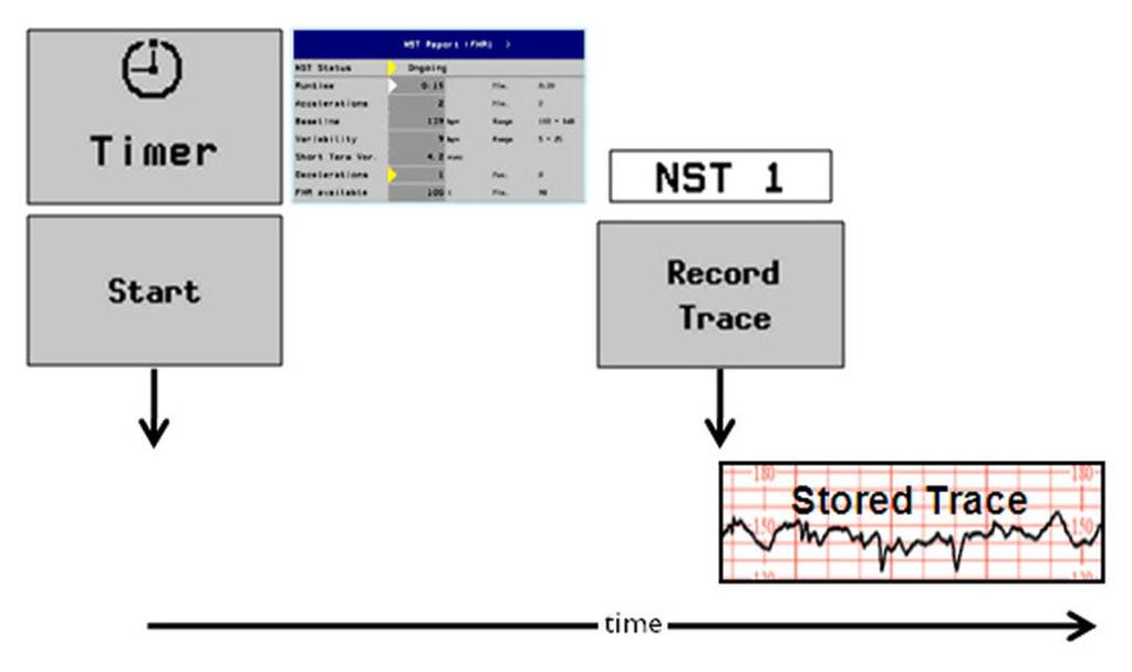 6 Monitor Settings Stored Trace Recording On Demand for Ongoing NST Trace Interpretation To configure this use model, configure the following settings: Setting Item Main Setup > NST Report > Setup >