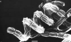 Streptomyces plicatosporus. by: K.