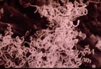 mycelium of Streptomyces http://www.