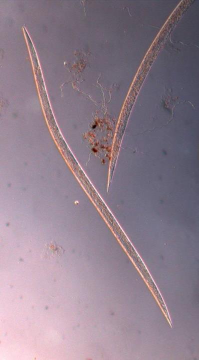 Stem and Bulb Nematode Ditylenchus dipsaci microscopic nematodes 1.