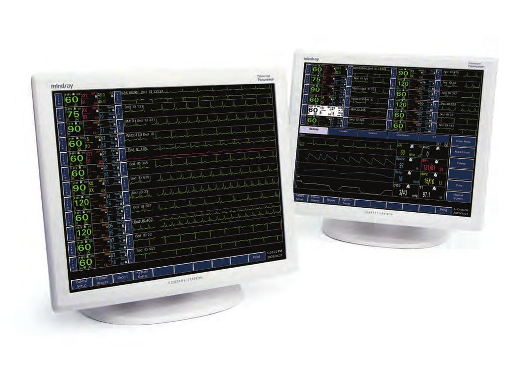 Choice of single or dual display allows expansion of the Panorama System as monitoring needs grow.