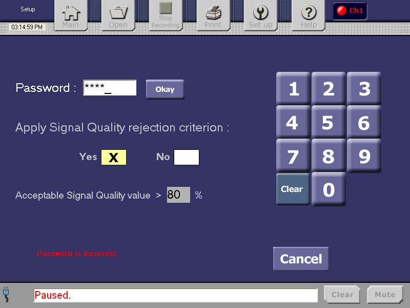 Operator s Manual Page 27 of 79 If you are a researcher who needs to alter the signal quality criterion, contact