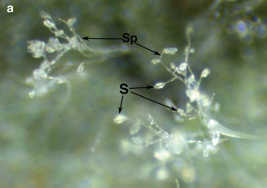 Figure 7. (a) Sporangia (S) of P. infestans are formed on sporangiophores (Sp).