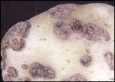 Severity of symptoms determined by: Strain of pathogen Potato