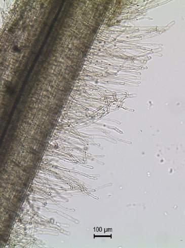 6. The position and the appearance of root hairs in relation to