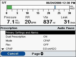 Insert an SD Card with a valid prescription into the device. A Change Prescription? message appears on the display: 2.