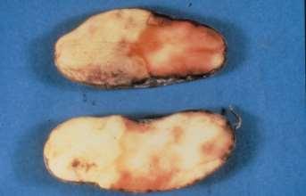Pink Rot Caused by Phytophthora erythroseptica Infection