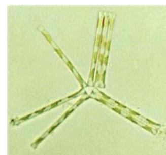 Micro-plants: Phytoplankton: If you take a sample of the water and view it under a