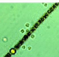 newts. Diatoms Green algae Blue-green algae Plankton photos from: pondsofchestercountypa.
